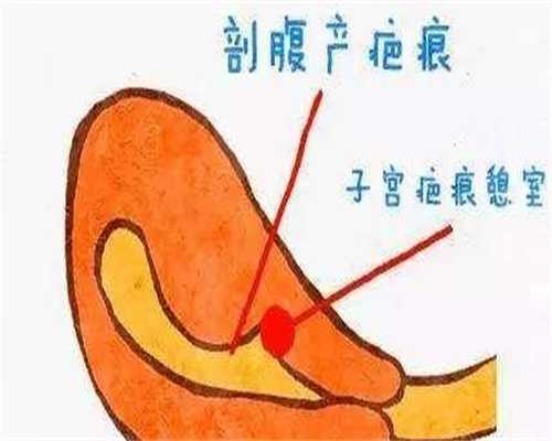 辅助生殖科普