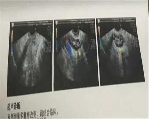 辅助生殖科普
